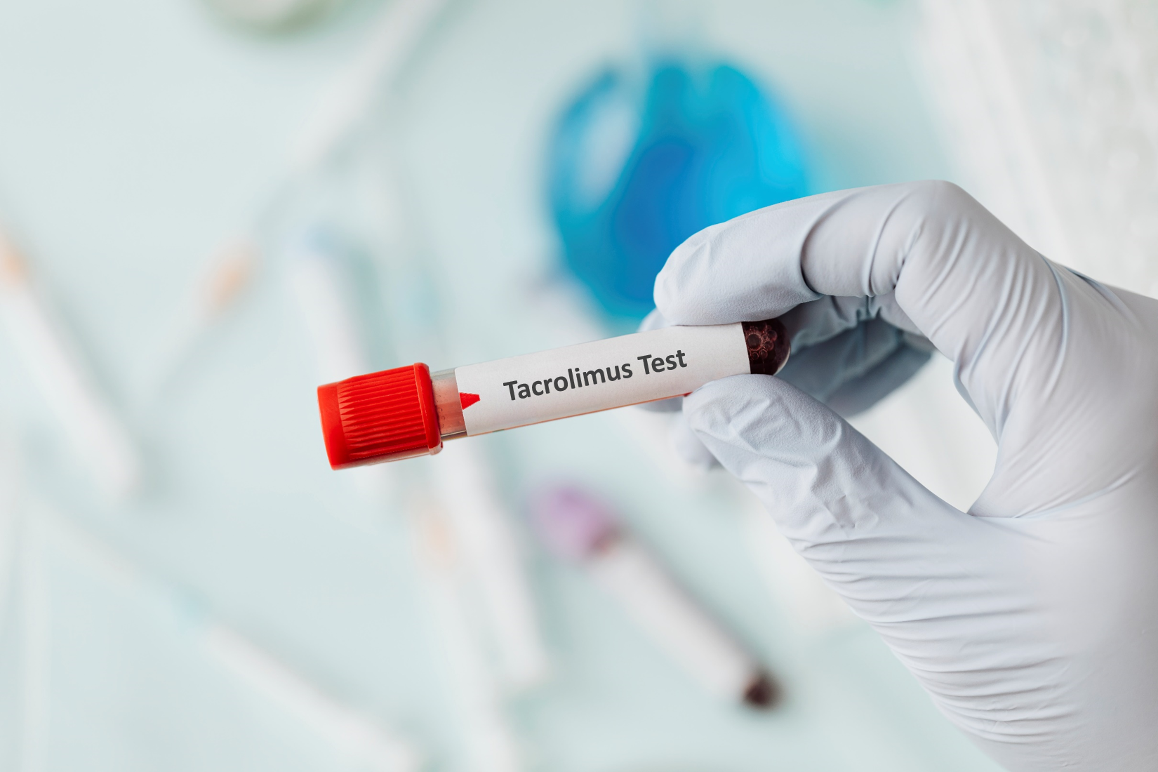 Tacrolimus Test